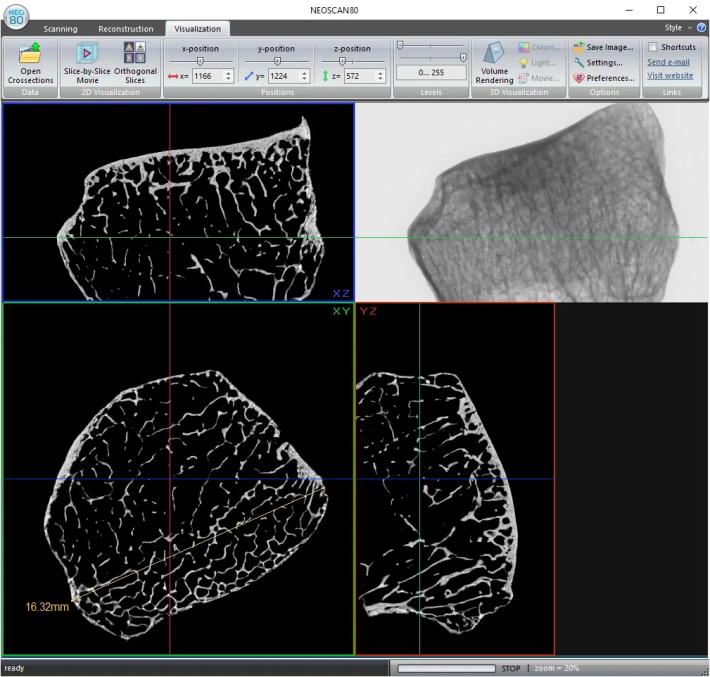 NEOSCAN N80 Scientific grade, high-resolution micro-CT scanner ...