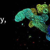 3D fluorescence imaging of organoids revealing complex internal structures at depth.