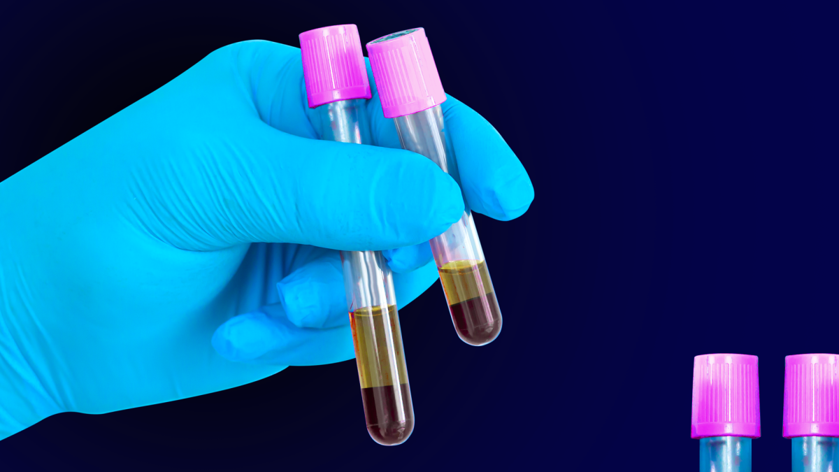 qEV + AFC + Exoid: il workflow completo Izon per isolare e caratterizzare vescicole extracellulari con alta precisione