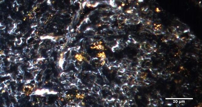 Immagine iperspettrale di nanoparticelle d'oro nei tessuti