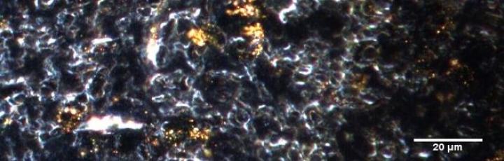 Immagine iperspettrale di nanoparticelle d'oro nei tessuti