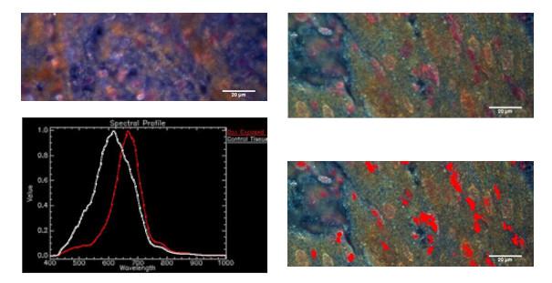 Mappatura iperspettrale di agenti chemioterapici in tessuti
