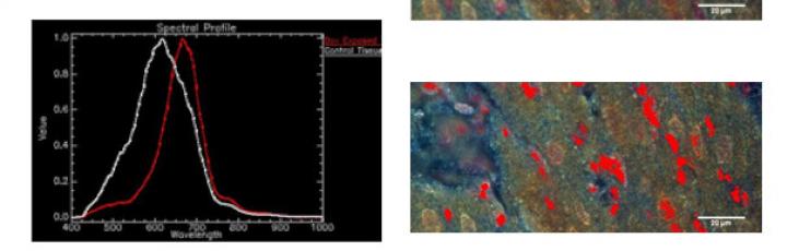 Chemotherapy Hyperspectral  Mapping in Tissue 