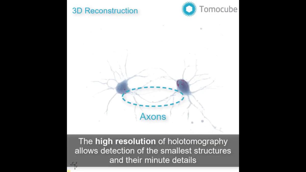 Neuroni primari di topo ripresi con l'olotomografia di Tomocube