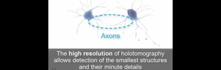 Neuroni primari di topo ripresi con l'olotomografia di Tomocube