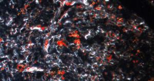 AuNP Spectra Mapped (red) in Tissue