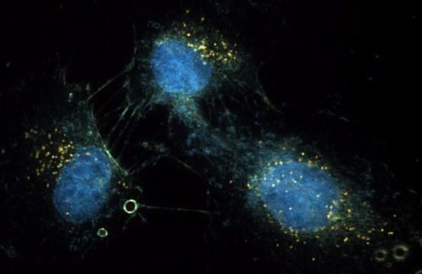 This image shows live cells where both the fluorescently stained DAPI nucleus, as well as unlabeled 80nm Au particles and unstained cell structurecan be seen simultaneously and in real time. This is capable using CytoViva’s patented Dual Mode Flourescent Module