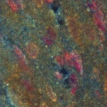 Figure 2: Ex-Vivo Stained Heart Tissue Exposed to Doxorubicin