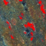 Figure 4: Mapping (in red) of All Pixel Matching the Spectral Response of Doxorubicin Exposure