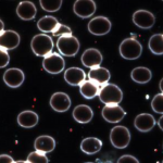  Figura 3: Mappatura spettrale (rossa) dei pixel che corrispondono allo spettro del virus, tratta dall'immagine nella figura 1.