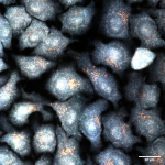 Figura 1 - Nanoparticelle d'oro internalizzate in cellule
