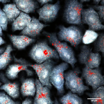  Figura 3 - Mappatura di nanoparticelle d'oro (in rosso) dentro a cellule