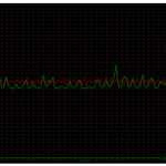 Pump on Soto150 – vibrations measurements