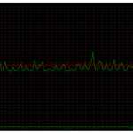 Pump on Soto150 – vibrations measurements