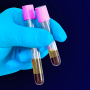 qEV + AFC + Exoid: il workflow completo Izon per isolare e caratterizzare vescicole extracellulari con alta precisione