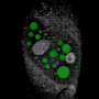 Seeing LLPS (liquid liquid phase separation) with holotomography