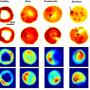 Three-dimensional refractive index and phase map of P. knowlesi-infected RBCs.