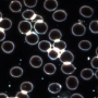 Whole blood sample from subject experiencing viral infection symptoms. Note, bluish viral particles present throughout the image